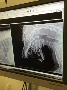 An X-ray of Bruno's shattered jaw